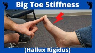 Stiff Big Toe Joint Hallux Rigidus Treatment