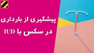 پیشگیری از بارداری در سکس با IUD