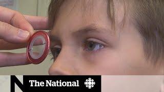 Too much screen time may be damaging kids eyesight