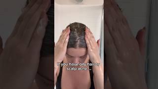 STOP DOING THIS oily hair + scalp acne trick #shorts #trichologist #healthyhair #healthyscalp