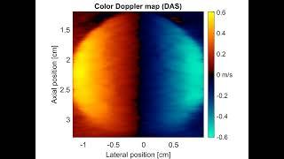 Rotating Disk Color Doppler  - DAS Vs Proposed NLHR