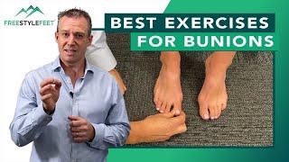 Best exercises for Bunions