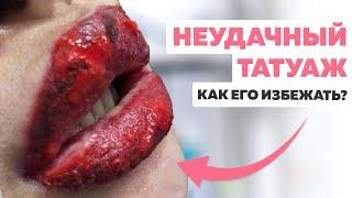 Неудачный татуаж что делать? Ужасы татуажа. Мой неудачный опыт.