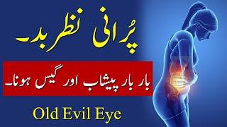 Purani Nazar e Bad Bar Bar Pishab aur Gas hona aur illaj Old Evil Eye