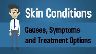 Skin Conditions - Causes Symptoms and Treatment Options