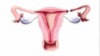 Fallopian Tube Animation