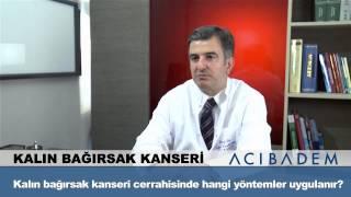 Kalın bağırsak kanseri cerrahisinde hangi yöntemler uygulanır ?