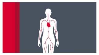 What is atrial fibrillation?