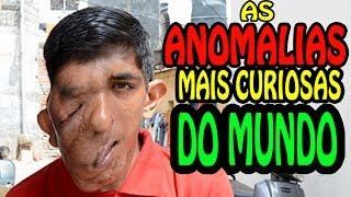  As Anomalias mais CURIOSAS do Mundo