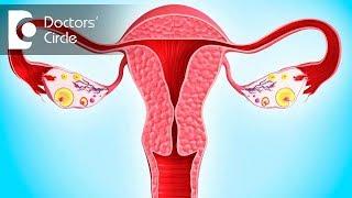 Can Polycystic Ovaries cause high prolactin & androgen levels? - Dr. Anjana Ramesh