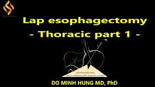 LAP ESOPHAGECTOMY   THORACIC PART 1