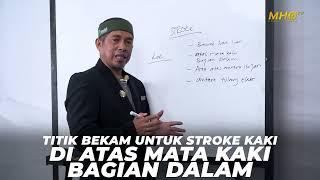 Mengenal Lebih Dekat Thibbunabawi - Titik Bekam Stroke Kaki