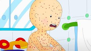 Chicken Pox  Caillou  WildBrain Kids