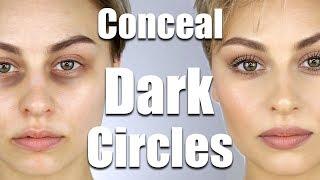 How To Conceal Dark Circles Under Eyes  Alexandra Anele