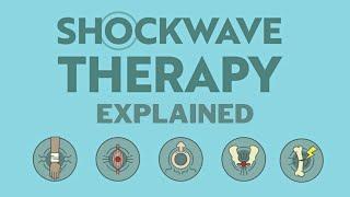 What is Shockwave Therapy? Does it Really Work?