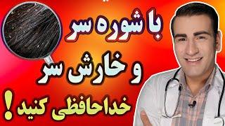 درمان شوره سر و درمان خارش سر در خانه - How to Treat Itchy Dandruff at Home - RU EN 4K