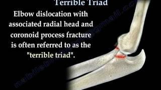 Elbow Fracture Dislocation Terrible Triad - Everything You Need To Know - Dr. Nabil Ebraheim