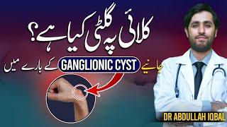 Wrist Ganglion Cyst Causes  Ganglion Cyst Home Treatment  Ganglion Cyst Remedy