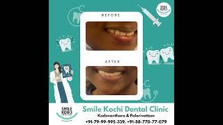 Smile Kochi Dental Clinic  Kadavanthara  PalarivattomSmile Kochi Dental Clinic