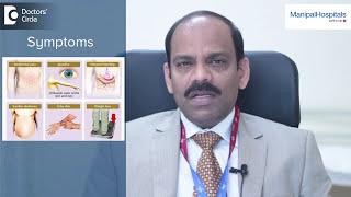 How Is Liver Cancer Diagnosed? Top Hepatologist In India - Dr. Olithselvan  Manipal Hospitals