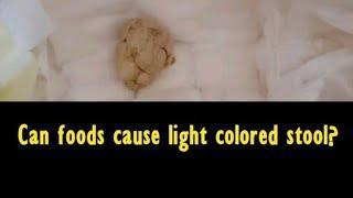 Can foods cause light colored stool?