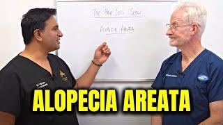 Alopecia Areata & Hair Loss Things You Need To Know