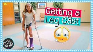 GETTING A LEG CAST FOR BROKEN FOOT  DANCE INJURY