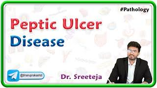9. Peptic Ulcer Disease  USMLE Step 1 Pathology