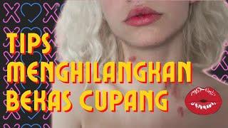 TIPS AND TRICKS PRAKTEK MENGHILANGKAN BEKAS CUPANG #CUPANG #KISS