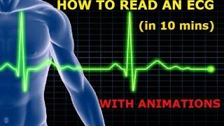 HOW TO READ AN ECG WITH ANIMATIONSin 10 mins