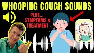 Doctor explains WHOOPING COUGH plus examples of REAL SOUNDS  Symptoms diagnosis treatment & more