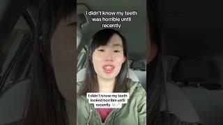 Why This Girl Was BULLIED For Her Teeth 