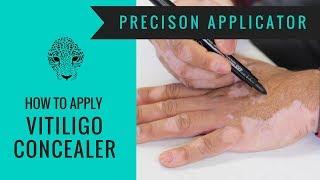 Vitiligo Makeup Tutorial - How to Cover Vitiligo - Zanderm Precision Applicator