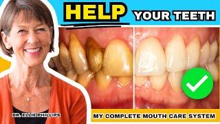 How To Create Healthy Teeth - My Complete Mouth Care System Step-by-Step