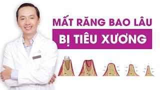 Mất răng bao lâu thì bị tiêu xương  Giải pháp phục hồi xương hàm  Nha khoa Elite