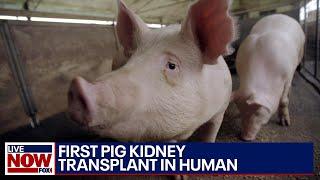 Medical Miracle First pig kidney transplant in human  LiveNOW from FOX