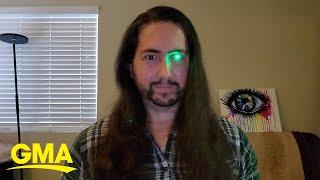 Man loses eye to cancer turns prosthetic eye into flashlight l GMA