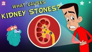 What Causes Kidney Stones?  The Dr. Binocs Show  Best Learning Videos For Kids  Peekaboo Kidz