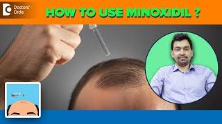 MINOXIDIL for Hair Loss- 2% 5 % 10%12.5% 15% ? & Side Effects-Dr.Rajdeep Mysore Doctors Circle