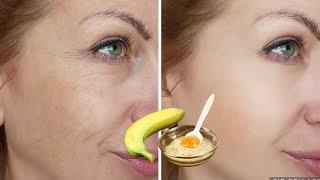 NATURAL BOTOXApply Banana  On Your Skin Anti-Aging Wrinkle Remover and Spotless Firm Skin #botox