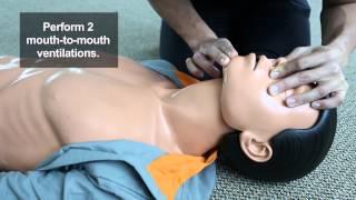 Mouth to Mouth Ventilations CPR Steps