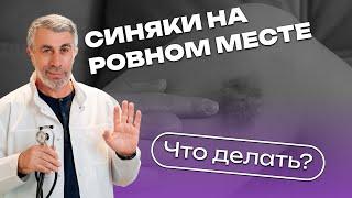 Синяки на ровном месте. Что делать?