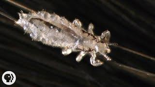 How Lice Turn Your Hair Into Their Jungle Gym  Deep Look