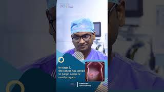 Liver Metastasis in Stage 4 Cancer Key Differences and What They Mean  Dr Praveen Kammar