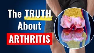 The Biggest Lies About Knee Osteoarthritis - DEBUNKED