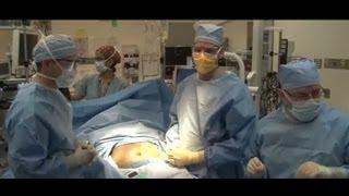 Laparoscopic Sleeve Gastrectomy Video - Brigham and Womens Hospital