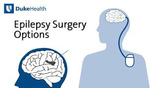 Epilepsy Surgery Options  Duke Health