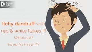 Itchy dandruff with red & white flakes  What is it? How to treat it? - Dr. Aruna Prasad