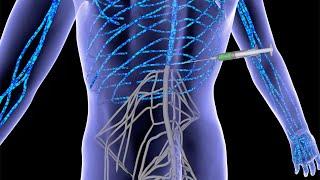 Severe spinal cord injuries repaired with dancing molecules