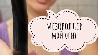 Мезороллер. Мой опыт плюсы работы с ним и основные рекомендации